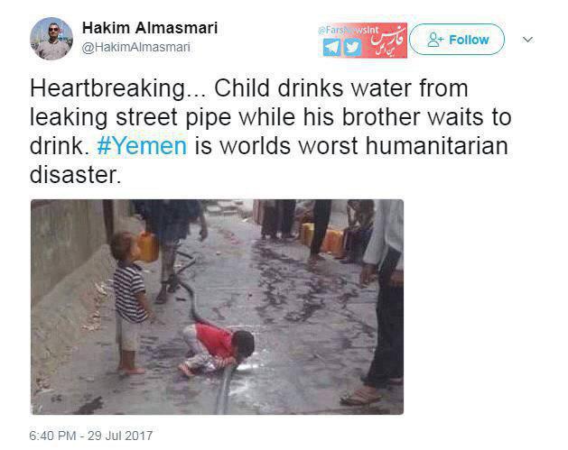 عکس تکان دهنده از وضعیت کودکان درمانده یمن