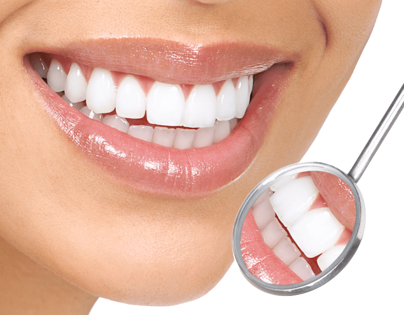 کامپوزیت و لمینت چه بلایی بر سر دندان‌ها می‌آورد؟