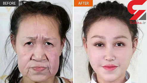 جراحی زیبایی یک پیرزن را به دختری ۱۵ ساله تبدیل کرد +عکس