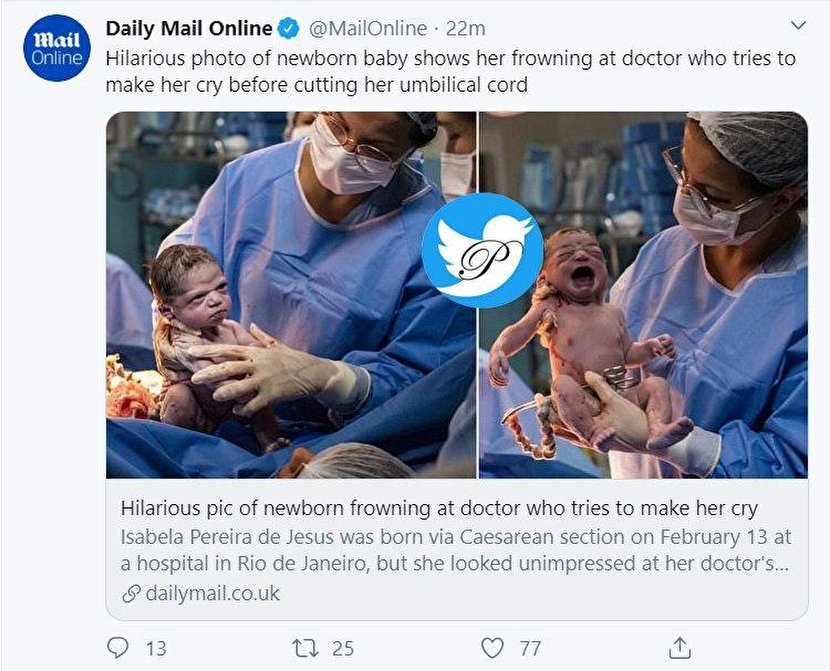 نگاه عجیب نوزاد تازه متولد شده به پزشک سوژه شد! +عکس