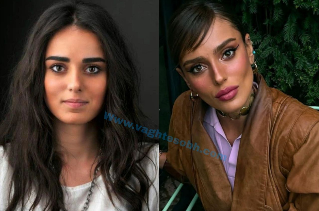 تغییرات شگفت انگیز خانم بازیگر بعد از عمل+ تصاویر