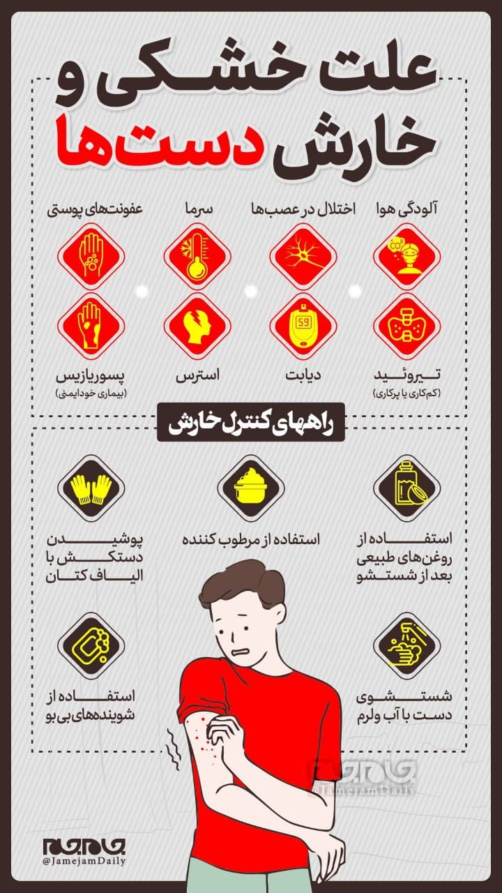 دلایل خشکی و خارش دست‌ها +اینفوگرافیک